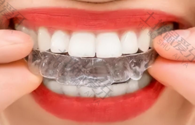 隐形牙套矫正效果 隐形牙套是怎么矫正牙齿的 