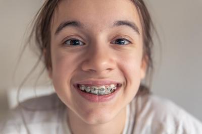 矫正牙齿保持器要戴多久？牙齿矫正什么年龄合适？