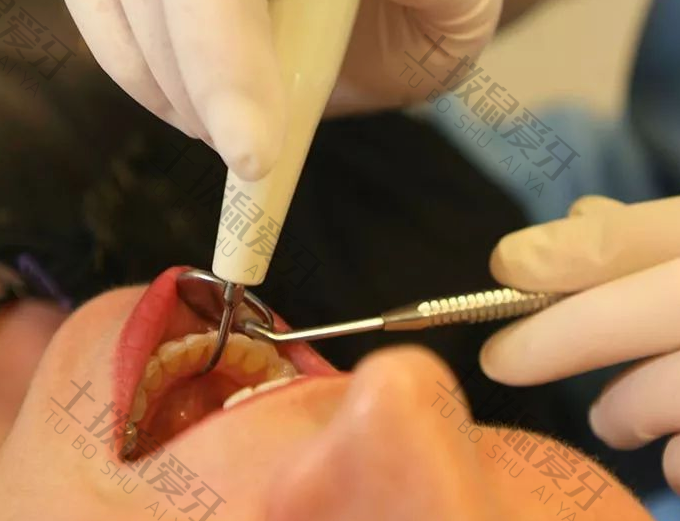 牙髓炎治疗后为什么还痛