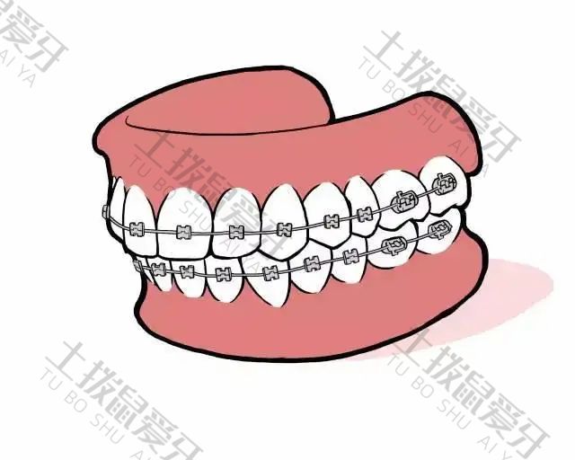 牙齿大门牙外突矫正价格