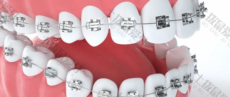 牙齿矫正器种类和价格