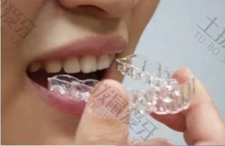 二次矫正牙齿的价格