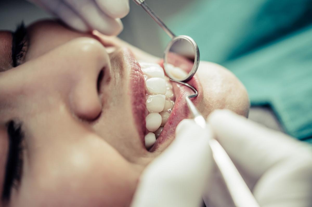 树脂补牙的基本过程