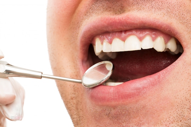 成人牙齿深覆合是否需要矫正