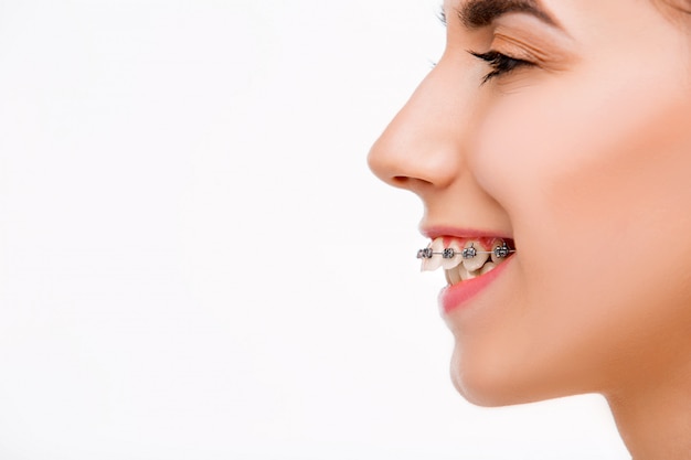 成人牙齿矫正能否使用医保报销