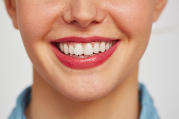 牙齿美白和洗牙的区别