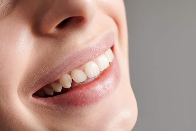牙龈上横着长的牙齿矫正的必要性