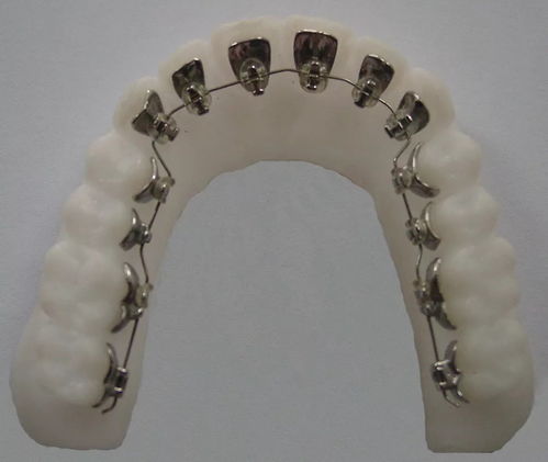 如何选择合适的牙齿矫正医生