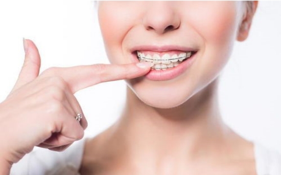 选择矫正牙齿医院的关键因素