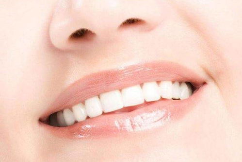 复合树脂补牙的优缺点