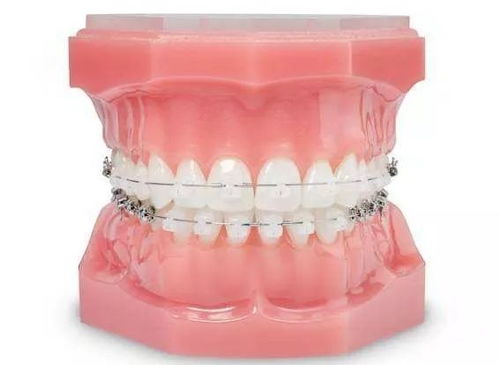 选择正规牙齿矫正医院的方法