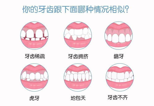 牙颌畸形的预防