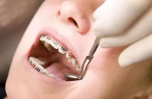 不正规医院进行牙齿矫正的危害