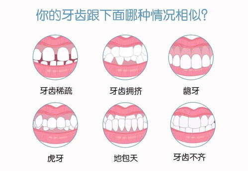 常见的错颌畸形治疗方法