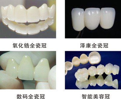 做全瓷冠后注意事项