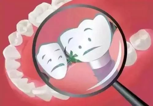 前牙种植需要满足哪些条件 需要磨牙吗