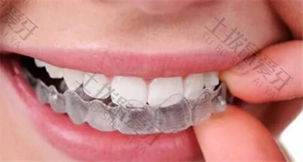 透明牙套矫正牙齿真的有效果吗