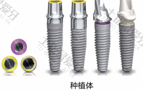 瑞士iti种植牙优点