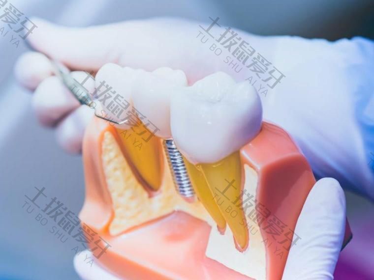 种植牙手术费可以用医保吗