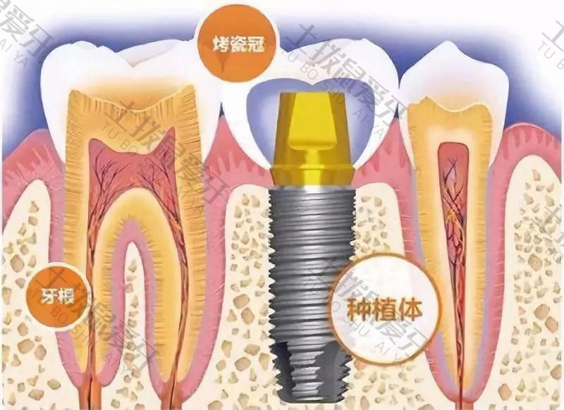 韩国登腾和奥齿泰哪个好