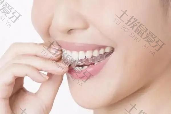 智齿会影响牙齿矫正吗