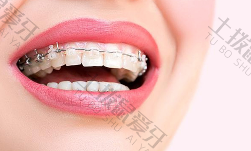 牙齿稀疏矫正方法