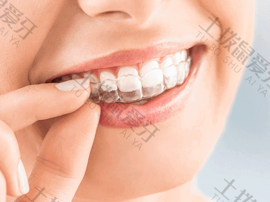牙齿稀疏能矫正吗
