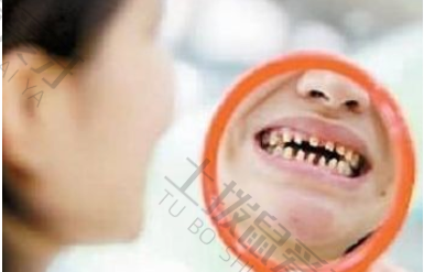 大人牙齿稀疏牙缝大怎么矫正