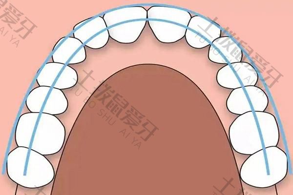 拔智齿矫正牙齿可以改善凸嘴吗