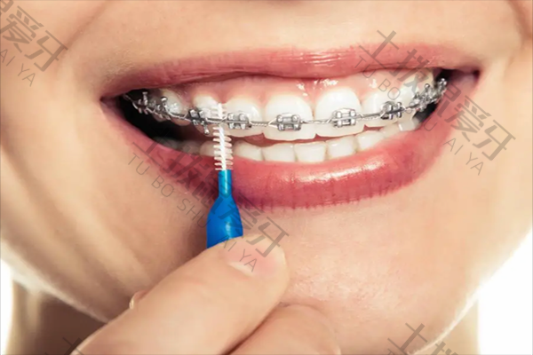 拔智齿矫正牙齿可以改善凸嘴吗