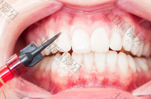 牙齿早期矫正干预方法