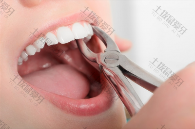 矫正牙齿可以拔门牙吗 牙周炎可以矫正牙齿吗
