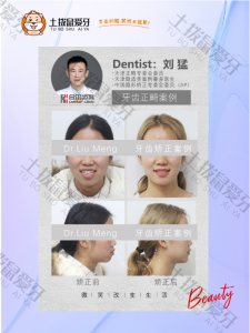 女士嘴凸，牙齿轻度不齐正畸案例