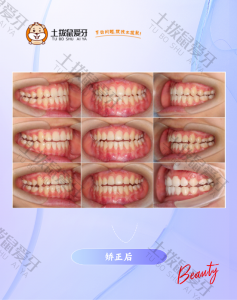 治疗后