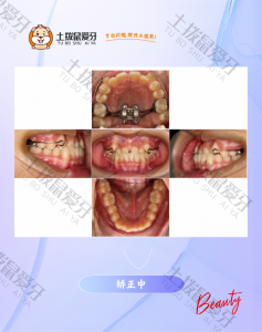 治疗过程