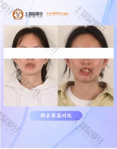 坏牙多