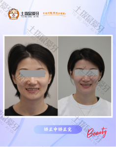 时代天使精调（女）
