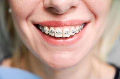 33岁能否矫正牙齿？矫正牙齿导致牙齿松动怎么办？