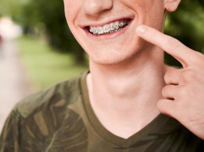 常州地包天牙齿怎么矫正？矫正牙齿的矫治器有哪些？