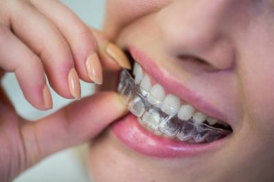 隐形牙套如何矫正牙齿，牙齿很歪可以用隐形牙套吗？