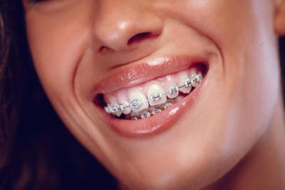 在天津做牙齿矫正费用是多少，智齿没长出来影响矫正牙齿吗