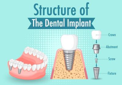 哪个种植牙手术环节会比较痛苦？种植牙手术危险吗？