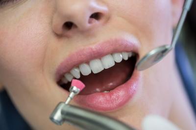 吸附性义齿与普通义齿选择之间的抉择