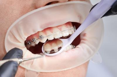 小孩口腔医院拔牙需要做哪些检查，矫正牙齿拔牙另收费吗