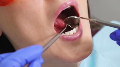 2024佛山口腔医院拔牙矫正价格表，矫正牙齿是磨牙还是拔牙好？