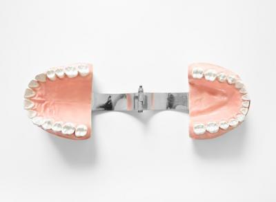 哪些根管秘密是医生不会说的？根管治疗后的牙齿能用多久？