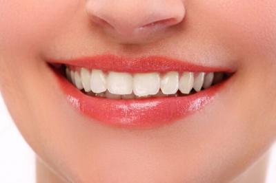 牙齿都有微笑线吗？牙齿微笑线能经过牙齿矫正得到吗？