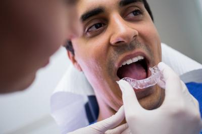 成人牙齿矫正有几种方法，矫正牙齿是不是戴牙套，牙套带多久？