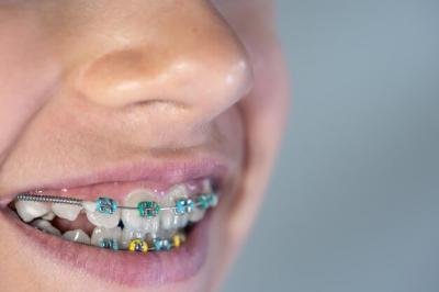 牙齿矫正期间睡觉咬牙齿是什么原因引起的，这种情况影响矫正效果吗