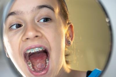 孩子几岁矫正牙齿比较好？MRC牙齿矫正器如何？